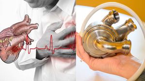 వైద్య చరిత్రలో అద్భుతం..గుండె ఆగిపోయినా 100 రోజులుగా బతికే ఉన్నాడు!