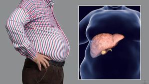 సాధారణ వ్యాధి కాదు,సైలెంట్ కిల్లర్: ఏం కాదులే అని లైట్ తీసుకున్నారంటే ఇక అంతే!