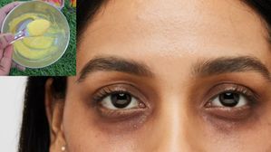 ఇది ఒక్క చుక్క రాసుకుంటే చాలు, క్షణంలోనే డార్క్ సర్కిల్స్ మాయమైపోతాయి.. అందరి ఇంట్లో ఉంటుంది!