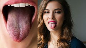 Tongue Changes : మీ నాలుకపై ఇలా  కనిపిస్తున్నాయా? బీ కేర్ ఫుల్..క్యాన్సర్ సంకేతమే!