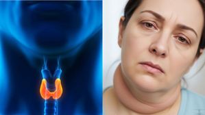 మీ శరీరంలో ఈ మార్పు కనిపిస్తే థైరాయిడ్ సంకేతమే!..ఇలా చేస్తే తప్పించుకోవచ్చు
