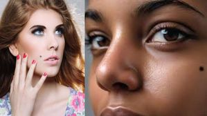 మీ ముఖంపై పుట్టుమచ్చలు ఉన్నాయా? అయితే మీ అదృష్టం, భవిష్యత్తు గురించి తెలుసుకోండి