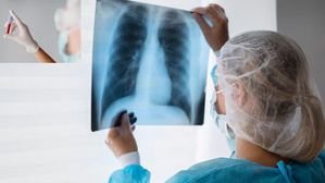 వైద్య శాస్త్రంలో అద్భుతం..ఖరీదైన స్కాన్‌ లకు చెక్..ఒక్క రక్త పరీక్షతో లంగ్ క్యాన్సర్‌ గుర్తింపు!