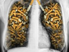 (ছবি) ধূমপায়ীরা ফুসফুস পরিষ্কার করতে পারেন এই টোটকা মেনে চলে