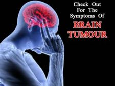 (ছবি) ব্রেন টিউমারের এই ১০ উপসর্গ সম্পর্কে ওয়াকিবহাল থাকুন!