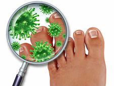 দাদ-হাজা-চুলকানির চোটে জেরবার? এমন রোগ সারাতে দারুন কাজে আসে এই ৮ টি ঘরোয়া পদ্ধতি!