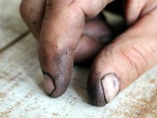 আঙুলের উপর সাদা ছোপ থাকার অর্থ কি জানা আছে?