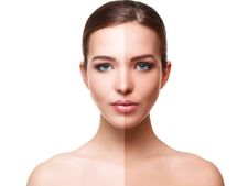 রোদে পোড়া চামড়া? সানট্যান দূর করবেন কী করে?