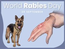 World Rabies Day 2021 : কেন পালন করা হয় এই দিবস? জানুন এর তাৎপর্য ও থিম