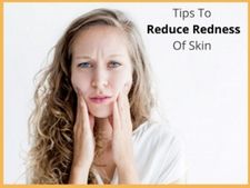 শীতকালে ত্বকের লালচে ভাব কমাবেন কীভাবে? সমস্যা সমাধানের জন্য রইল কয়েকটি টিপস্