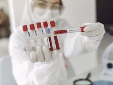 করোনা ভাইরাস : কনভ্যালেসেন্ট প্লাজমা থেরাপি কী? জেনে নিন কোভিড-১৯ প্রতিরোধে এটি কতটা কার্যকর