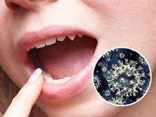 Black Fungus : এই মারাত্মক ফাঙ্গাল ইনফেকশন থেকে বাঁচতে মুখের যত্ন নিন, কীভাবে? দেখে নিন টিপস