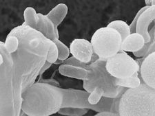 white fungus : ব্ল্যাক ফাঙ্গাসের পর এবার হোয়াইট ফাঙ্গাসের হানা! কতটা ভয়ঙ্কর এই সংক্রমণ?