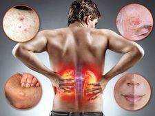 হাত-পায়ের ত্বক রুক্ষ, শুষ্ক হয়ে যাচ্ছে? কিডনির সমস্যায় ভুগছেন না তো?