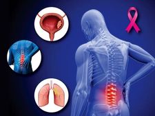 Cancer Symptoms : মাঝেমাঝেই পিঠে প্রচণ্ড যন্ত্রণা হয়? আপনি ক্যান্সারে আক্রান্ত নন তো?