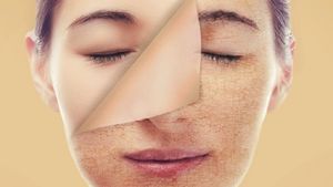 মৃত কোষে ত্বকের জেল্লা ঢাকা পড়ে যাচ্ছে? ঘরোয়া উপায়েই দূর হবে সমস্যা!