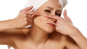 আপেল সাইডার ভিনেগারের গুণেই সারবে ব্রণ! কী ভাবে ব্যবহার করবেন?