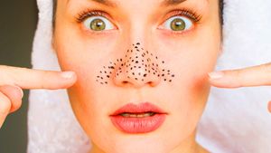 Blackheads Removal: ব্ল্যাকহেডসে ভরে যাচ্ছে নাক, থুতনি? টি ট্রি অয়েলের গুণেই দূর হবে সমস্যা