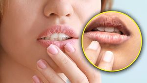 Summer Lip Care Tips: গরমকালেও ঠোঁট ফাটছে? এই ৬ উপায়েই দ্রুত উপশম হতে পারে!