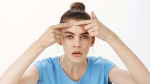 কপালে ব্রণ ভর্তি হয়ে গিয়েছে? হাতের কাছেই রয়েছে চটজলদি সমাধান!