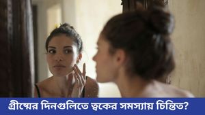 ঝকঝকে ত্বক পেতে নামী-দামি প্রোডাক্ট নয়, মেনে চলুন এই ৬ টি সহজ স্টেপ