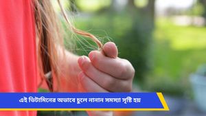 প্রতিদিন মুঠো মুঠো ঝরে পড়ছে চুল, ভয়ে চিরুনী ব্যবহার করছেন না? হতে পারে এই ভিটামিনের অভাব