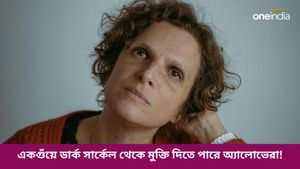 দিন দিন বাড়ছে চোখের নিচে কালো দাগ, এই সমস্যা রুখতে পারবে কি অ্যালোভেরা? জানুন