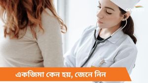  ত্বকে  জ্বালাভাব-চুলকানি? হতে পারে একজিমার লক্ষণ, কী কী এড়িয়ে চলবেন জানুন