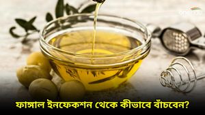 বর্ষায় হানা দেয় ফাঙ্গাল ইনফেকশন, আতঙ্কিত না হয়ে ভরসা রাখুন এই ঘরোয়া প্রতিকারে!