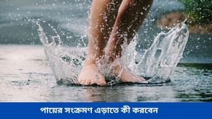 বৃষ্টি ভেজা জুতো দীর্ঘক্ষণ পরে থাকলে হতে পারে পায়ের সংক্রমণ, সমস্যা এড়াতে কী করণীয় জানুন