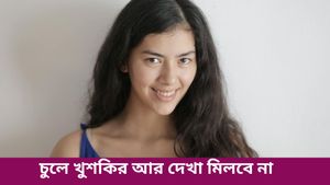 বর্ষাকালে চুল পড়া এবং খুশকির সমস্যায় ভুগছেন? চোখ বন্ধ করে ভরসা রাখুন এই প্রতিকারে 