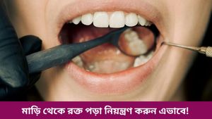 দাঁত ব্রাশ করতে গেলেই মাড়ি থেকে রক্তপাত, আইসক্রিমও দিতে পারে স্বস্তি, কীভাবে জানুন  
