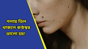 গলার ঠিক কোনদিকে তিল থাকা শুভ ইঙ্গিত দেয়? কী বলছে জ্যোতিষশাস্ত্র, জেনে নিন 