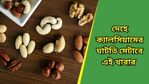 অল্প বয়সে হাড়ের সমস্যা? হাড়ের ক্ষয় রুখতে দেরি না করে এই খাবারগুলি বেছে নিন 