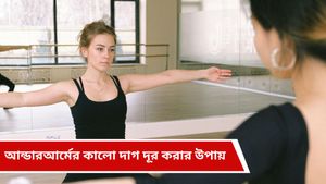 Beauty Tips: আন্ডারআর্মের কালো ভাব দূর হয়ে নিমেষেই, কাজ দেবে ম্যাজিকের মতো!   