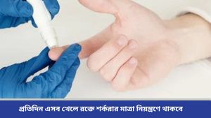 Diabetes Care: শুধু ওষুধ নয়, চিকিৎসকের পরামর্শ মত ডায়াবেটিস প্রতিরোধে ডায়েটে রাখুন এই খাবারগুলি 