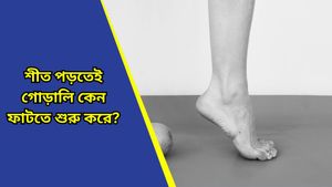 Skin health: শীত আসতেই গোড়ালি ফেটে চৌচির? সমস্যা এড়াতে রইল কিছু বিশেষ ও কার্যকরী টিপস