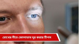 Yoga for beauty: দামি প্রসাধনী নয়, চোখের তলার ফোলাভাব কমাবে এই ৪ যোগাসনই!