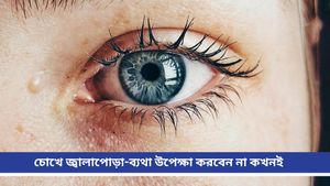  Eye care: চোখে ব্যথা-জ্বালাপোড়া নিতে পারে মারাত্মক আকার! জানুন নেপথ্যে থাকা কারণ 