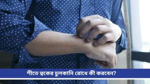 Itching: বারবার লোশন লাগিয়েও চুলকানি কমছে না? ঘরোয়া টোটকাতেই পাবেন মুহূর্তে আরাম!  