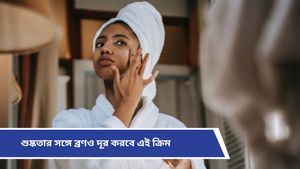 Winter skin care: রুক্ষ-শুষ্ক, প্রাণহীন ত্বককে বলুন বাই-বাই! কনকনে ঠাণ্ডায় ত্বকের যত্নে রইল টিপস 