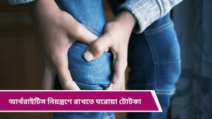 Arthritis: আর্থরাইটিসের ব্যথা ভোগাচ্ছে? ওষুধ তো খাবেনই, সঙ্গে রইল কিছু কার্যকরী ঘরোয়া টোটকা 