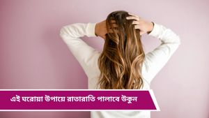 Home remedies for lice: মাথায় কিলবিল করছে উকুন! এই ঘরোয়া টোটকাতেই হবে উকুনের নাশ  