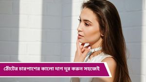 Hyperpigmentation: ঠোঁটের চারপাশে কালচে ছোপ অস্বস্তি বাড়াচ্ছে? কীভাবে প্রতিরোধ করবেন জানুন