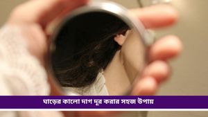 Neck patch: ঘাড়ের বিচ্ছিরি ছোপ দাগ সৌন্দর্য নষ্ট করছে? ঘরোয়া টোটকাতেই হবে ম্যাজিক 