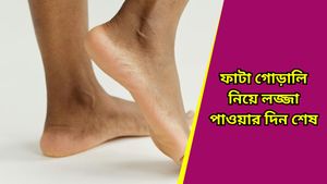 Cracked Heels: প্রতি শীত শেষেই পা ফেটে চৌচির? এই ঘরোয়া টোটকাতেই মসৃণ হবে গোড়ালি