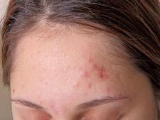 આ 9 સંકેતો વડે ઓળખો કે આપનાં શરીરમાં ગંદકી ભરાયેલી છે