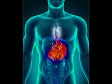 એસિડીટી અને છાતીની બળતરાથી છૂટકારો મેળવવા માટે કરો આ ૧૦ ફેરફાર