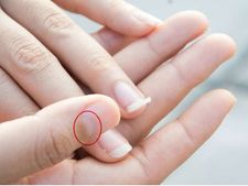 જો નખ પર અર્ધચંદ્ર દેખાય તો શું છે તેનો અર્થ?