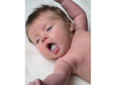 આ દેશી નુસખાથી ઠીક કરો બાળકના મોંઢાના છાલા 